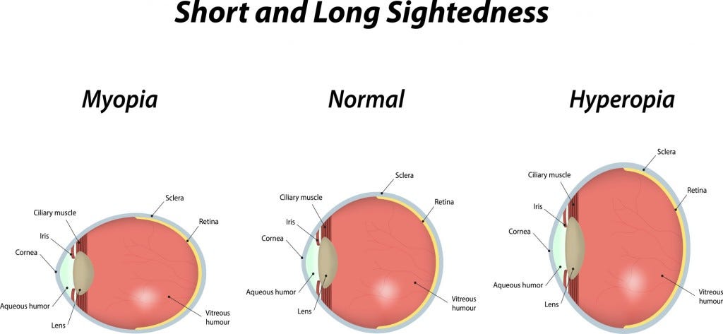 Nearsighted vs Farsighted